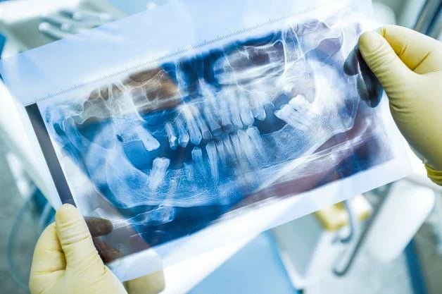 Behandeling van parodontitis bij rokende patiënten met de Lumoral-methode - Lumoral.