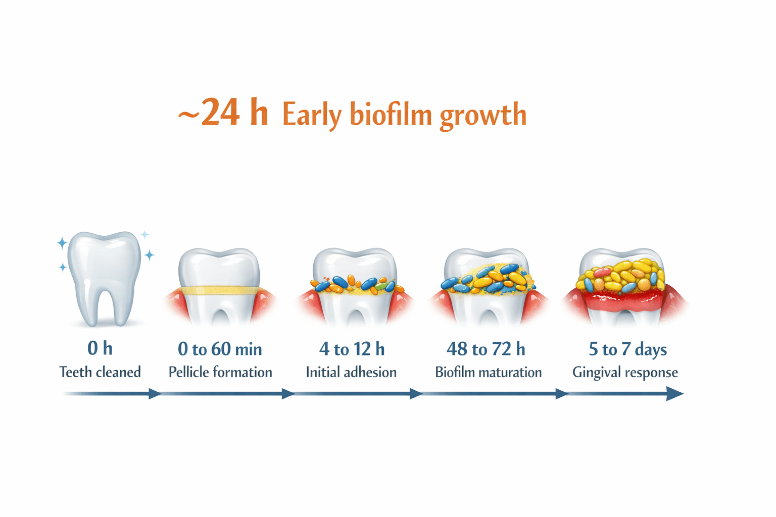Hoe tandplak zich opbouwt in tijd - Lumoral.