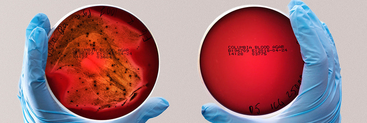 Porphyromonas Gingivalis plates