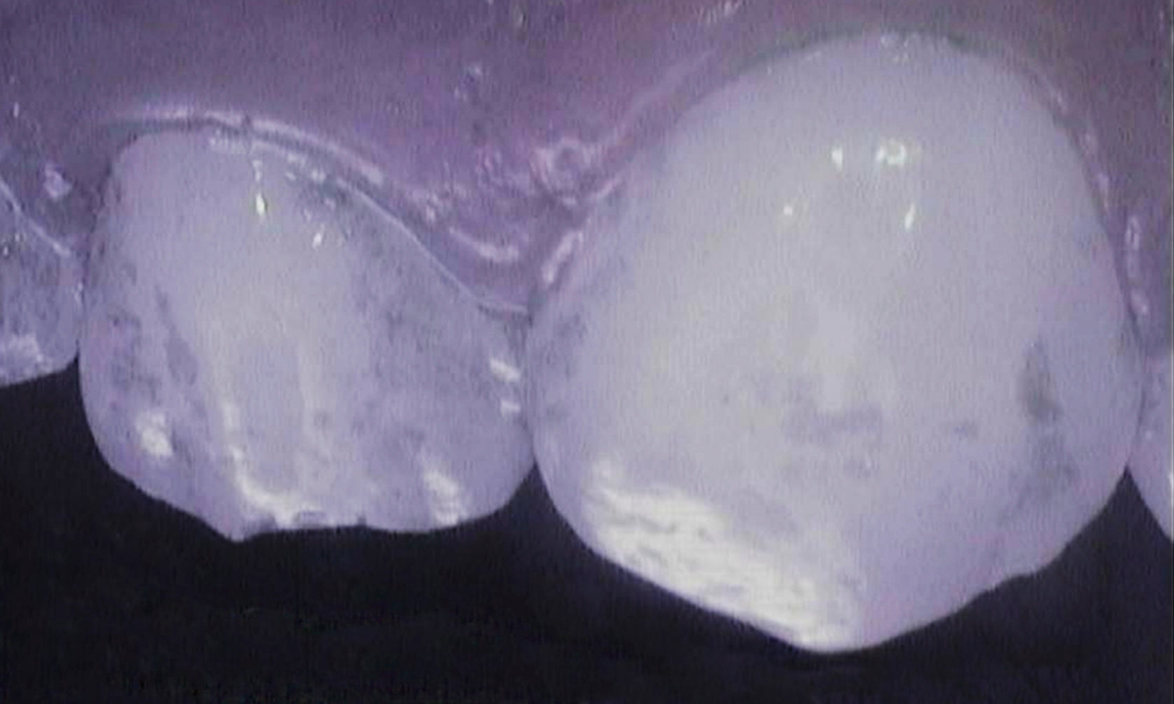 close up van tanden en bacteriën