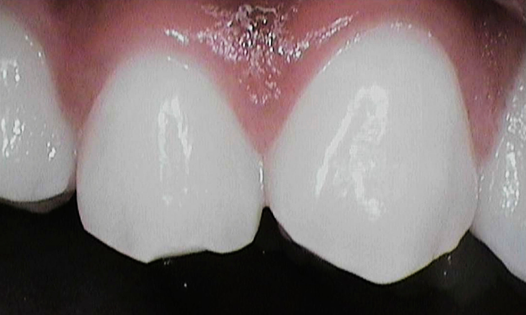 close up van witte tanden